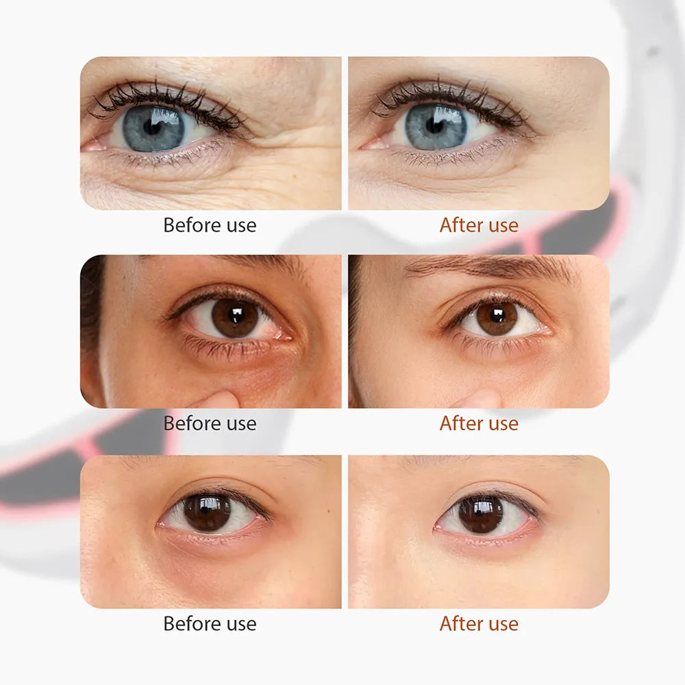 Luméro Revive™ Red Light Eye Therapy
